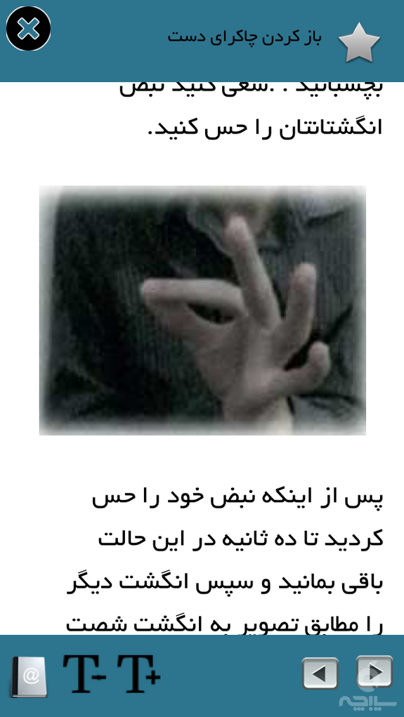 تله کینزی